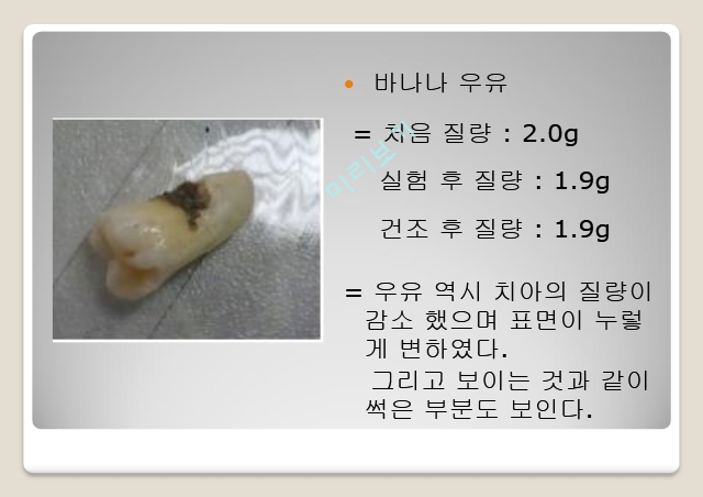 치아부식 실험,치아 부식의 원리,치아에 좋은 음식   (10 )